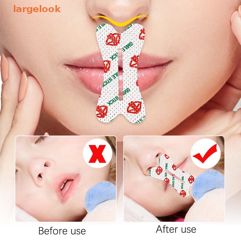 Set 30 Miếng Dán Mũi Chống Ngáy Khi Ngủ Tiện Dụng