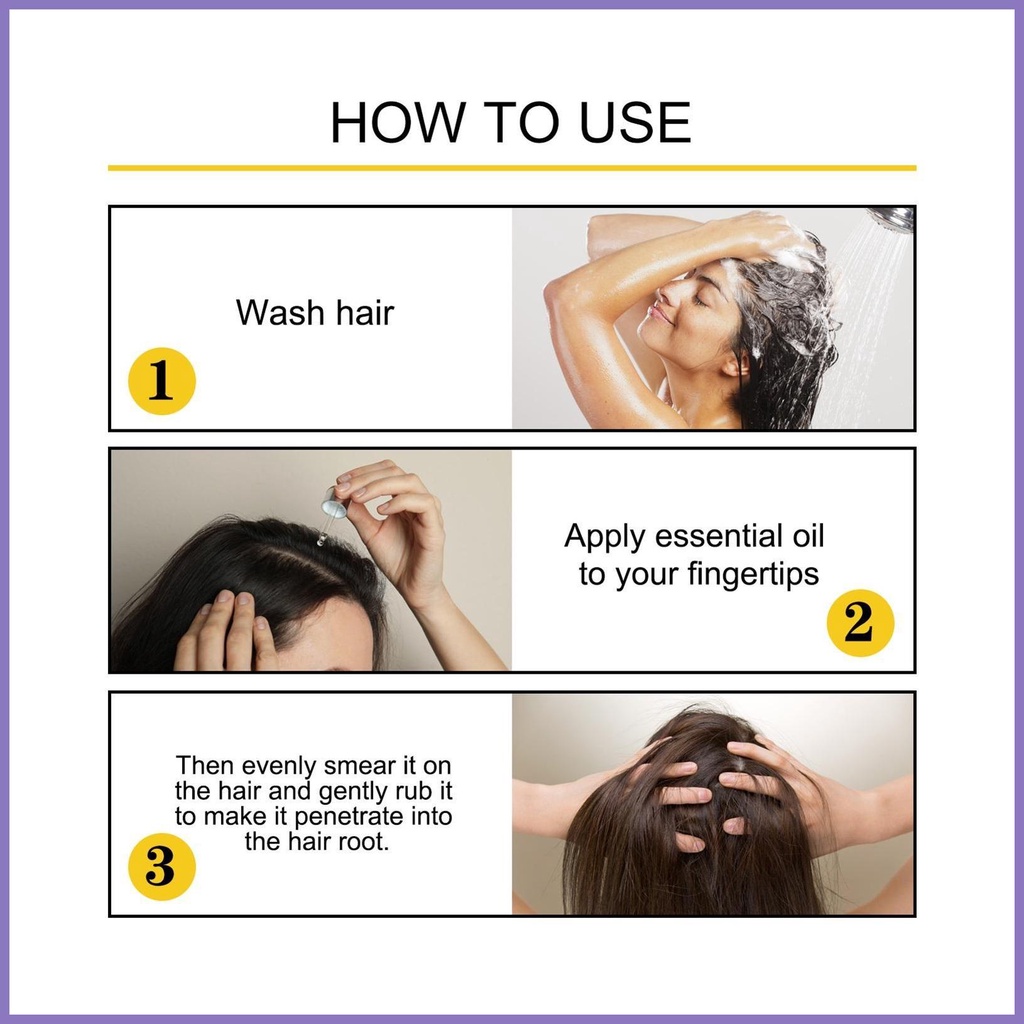 Tinh Chất Kích Thích Mọc Tóc 30ml An Toàn Cho Tóc Dày Hơn Và Rụng Tóc nota2vn