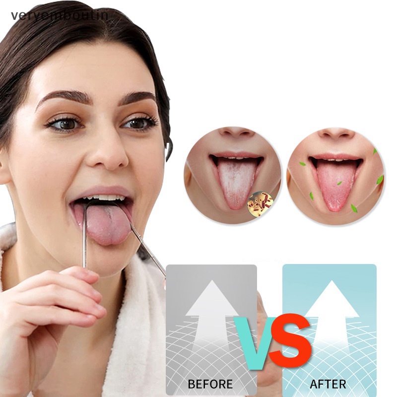 1 Dụng Cụ Vệ Sinh Lưỡi Bằng Thép Không Gỉ Chất Lượng Cao