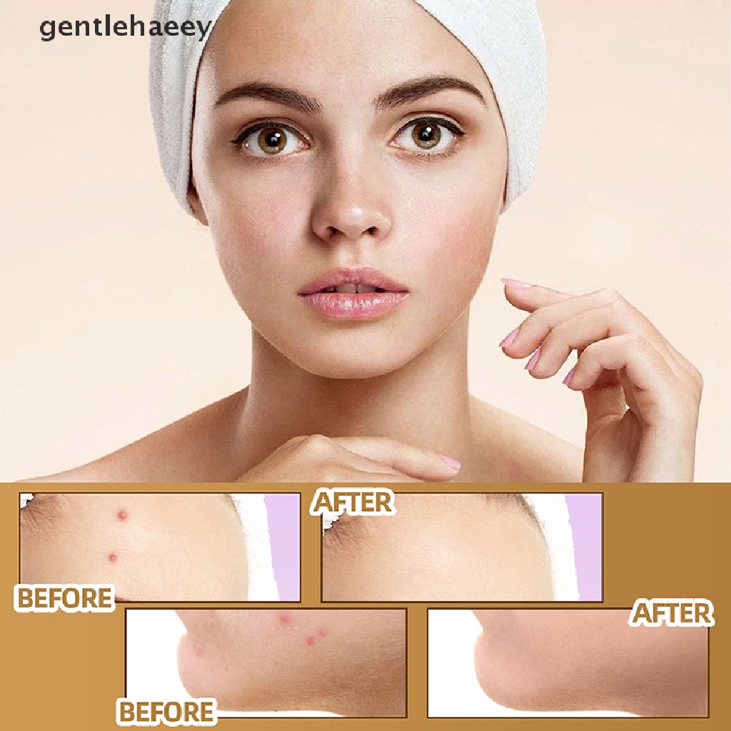 Bộ 60 Miếng Dán Che Khuyết Điểm Hình Xăm Chống Nước Che Phủ Mỏng