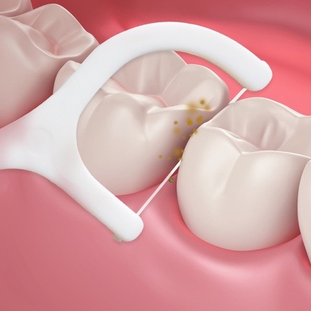 Tăm Chỉ Nha Khoa Sợi Chỉ Mảnh Tudi_house