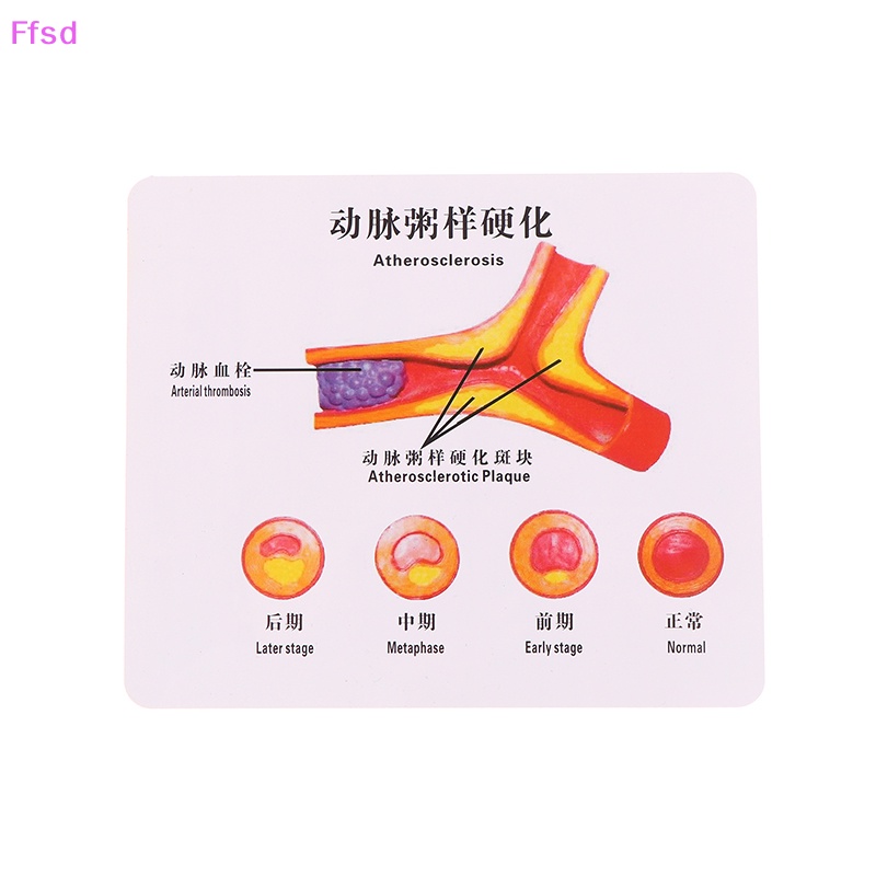 Tượng Vessel Con Người Nối Dài 50 Lần Cho Phòng Thí Nghiệm