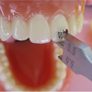 Dụng Cụ Đo Răng Miệng Bằng Thép Không Gỉ