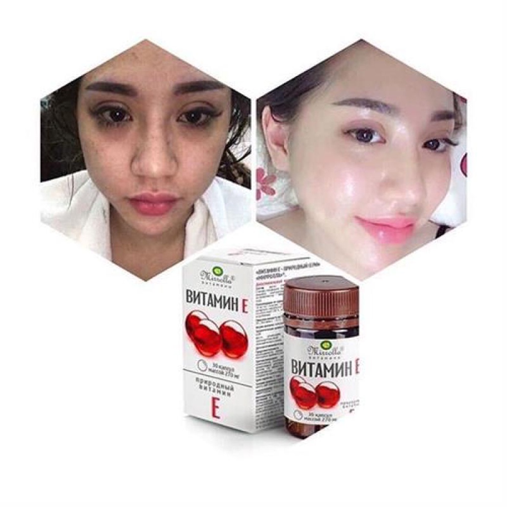 Vitamin E Đỏ Nga Tái Tạo Da, Ngăn Ngừa Lão Hóa, Mang Đến Vẻ Đẹp Trẻ Trung, Tự Nhiên Cho Chị Em phụ Nữ