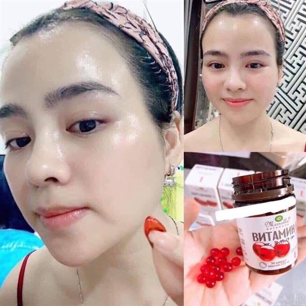 Vitamin E Đỏ Nga Tái Tạo Da, Ngăn Ngừa Lão Hóa, Mang Đến Vẻ Đẹp Trẻ Trung, Tự Nhiên Cho Chị Em phụ Nữ