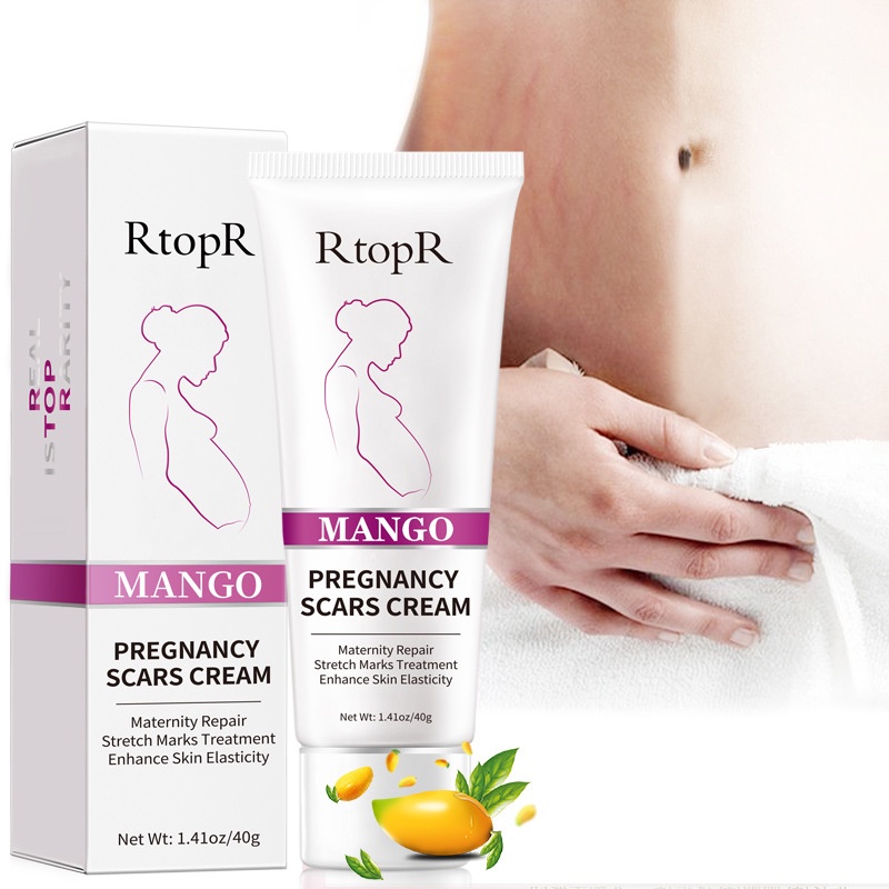 RtopR Xoài Xóa Sẹo Mang Thai Kem Rạn Da Kem Làm Săn Chắc Cơ Thể 40g YR