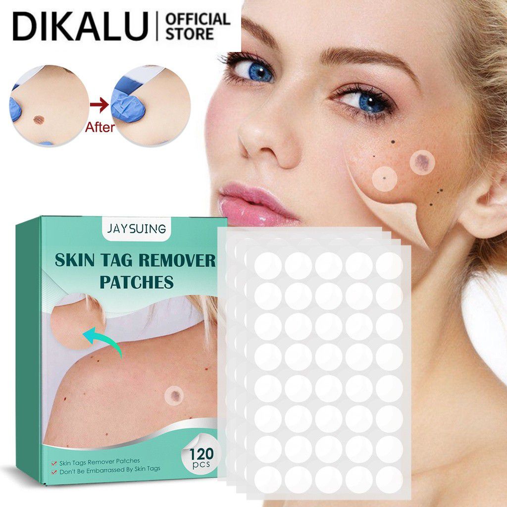 120 Cái/hộp Mụn cóc Tẩy Miếng Dán An Toàn Không Đau Da Thẻ Miếng Dán Mụn Điều Trị Mụn Cóc Miếng Dán beautysecret1
