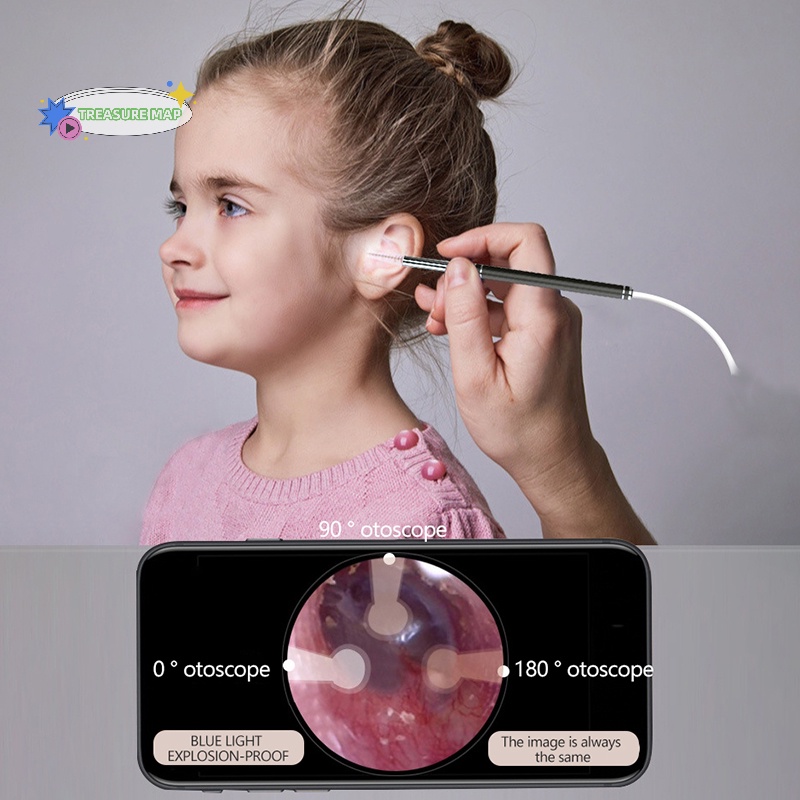 1 Bộ Dụng Cụ Lấy Ráy Tai Thông Minh heyuanlong333 Có camera