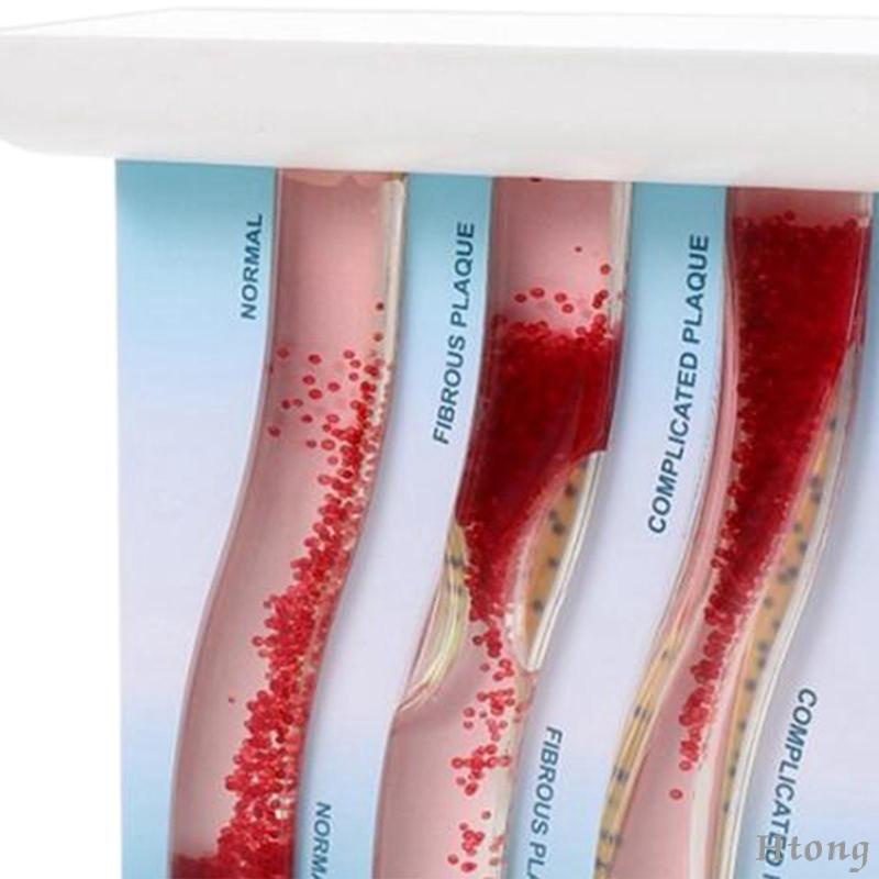 Vesel Mô Hình Bộ Xương Môi Tương Phản lipoprotein cardiovascular dynamic lipid Dùng Dạy Học