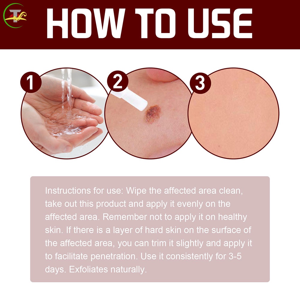 Arts Bút Tẩy Mụn Thịt Dư Trên Da Mặt Tiện Dụng