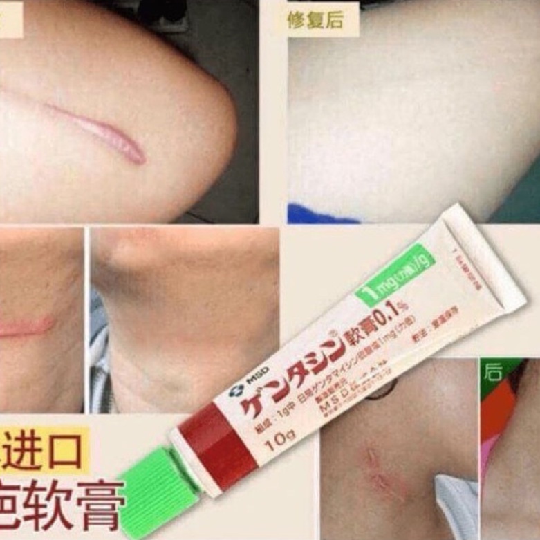 Kem mờ sẹo Gentacin Nhật Bản "Moci Shop"