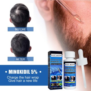 Tinh Chất Kích Thích Mọc Tóc minoxidil 5% minoxidil 60ml