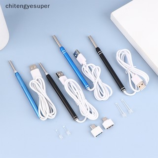 1 bộ dụng cụ lấy ráy tai thông minh quan sát ráy tai