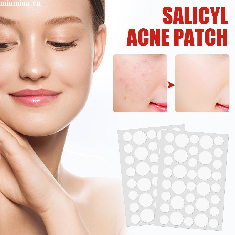 🔮Bộ 36 miếng dán Ngôi sao loại bỏ mụn chăm sóc da chuyên dụng