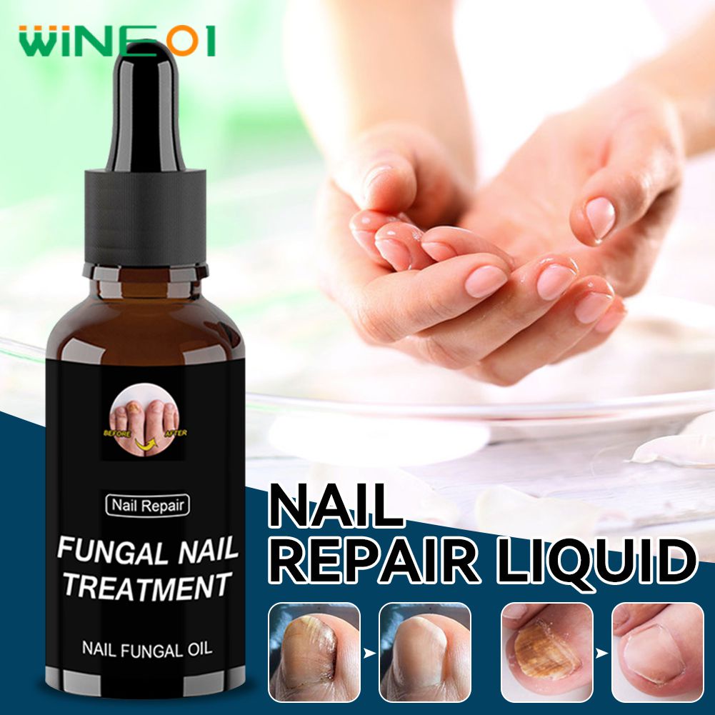 Eelhoe Nail Repair Serum Chân Sửa Chữa Tinh Chất Gel Loại Bỏ Nấm Sơn Móng Tay 30Ml/50Ml Sản Phẩm Chăm Sóc Móng Wine01