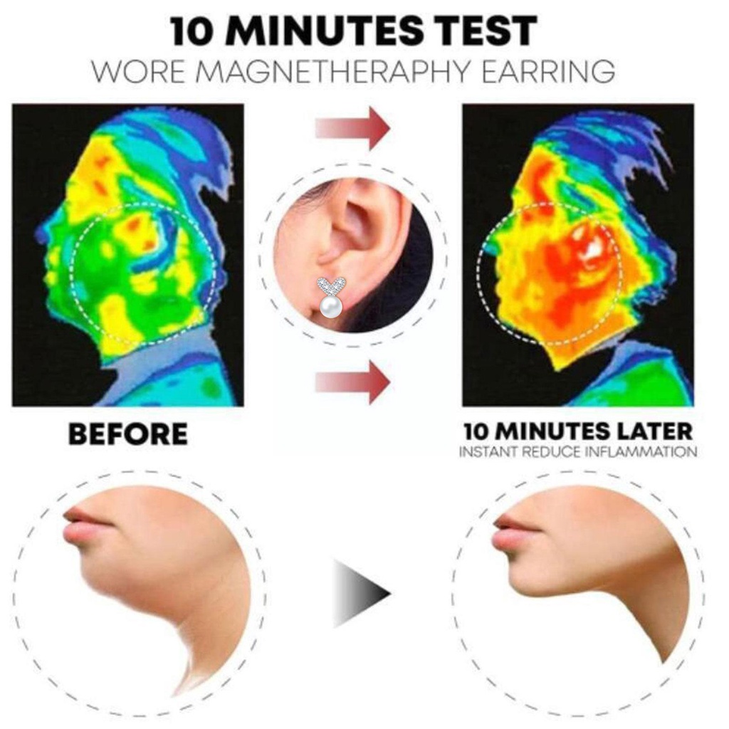 Khuyên Tai Nam Châm Châm Châm Bấm Huyệt Giảm Cân