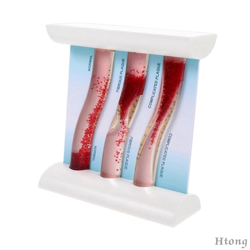 Vesel Mô Hình Bộ Xương Môi Tương Phản lipoprotein cardiovascular dynamic lipid Dùng Dạy Học