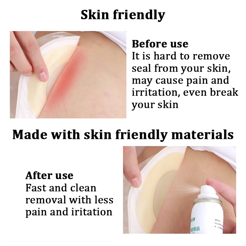 Ostomy Chai Xịt Loại Bỏ Keo Dán Chăm Sóc Sức Khỏe 30ml