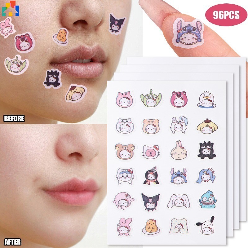 96 Cái Miếng Dán Mụn KT Cat Sanrio Hình Hỗ trợ giảm mụn Miếng Dán Vô Hình Mụn Loại Bỏ Mụn Miếng Dán 