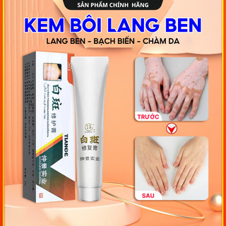 Kem Lang Ben TIANGE Hỗ Trợ Dứt Điểm Lang Ben, Bạch Biến, Chàm Da Hiệu Quả Hàng Xuất Khẩu NGA và THÁI LAN