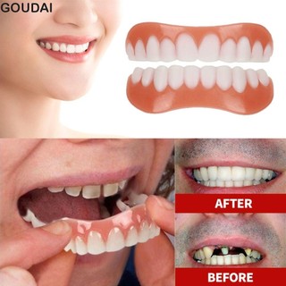 Goudai Trên Veneers Răng Silicon Thoải Mái Người Lớn