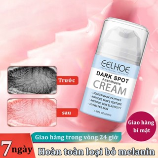 Kem làm trắng da Kem Thâm Nách kem làm trắng vùng kín bikini 50g Nuôi dưỡng và tái tạo da trắng sáng