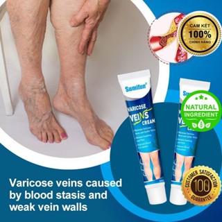 Kem Bôi Suy Giãn Tĩnh Mạch, Ngừa BIến Chứng, Lưu thông máu, Cam kết hết nặng chân, tê chân, ... thảo dược 100%