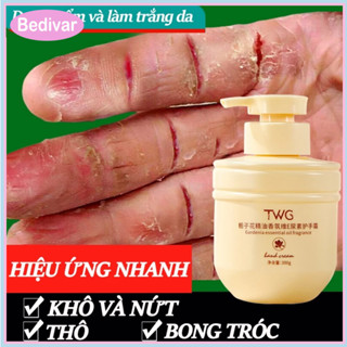  Bedivar Kem dưỡng da tay Dưỡng ẩm da tay Kem làm trắng tay 300g Dưỡng ẩm làm trắng da chống khô nứt nẻ tay chân 