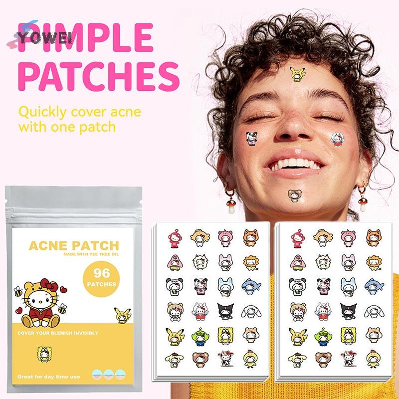 YOWEI 96 Miếng Dán Mụn Hoạt Hình Sanrio HelloKitty Hình Mụn Miếng Dán Vô Hình Mụn Loại Bỏ Mụn Miếng 