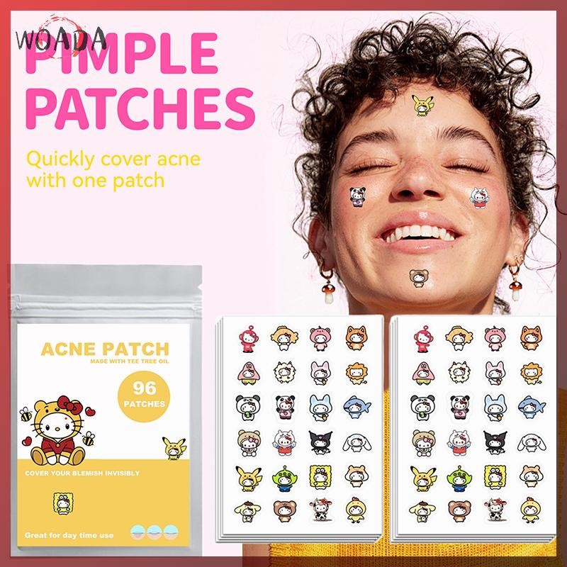 WOADA 96 Miếng Dán Mụn Hoạt Hình Sanrio HelloKitty Hình Mụn Miếng Dán Vô Hình Mụn Loại Bỏ Mụn Miếng 