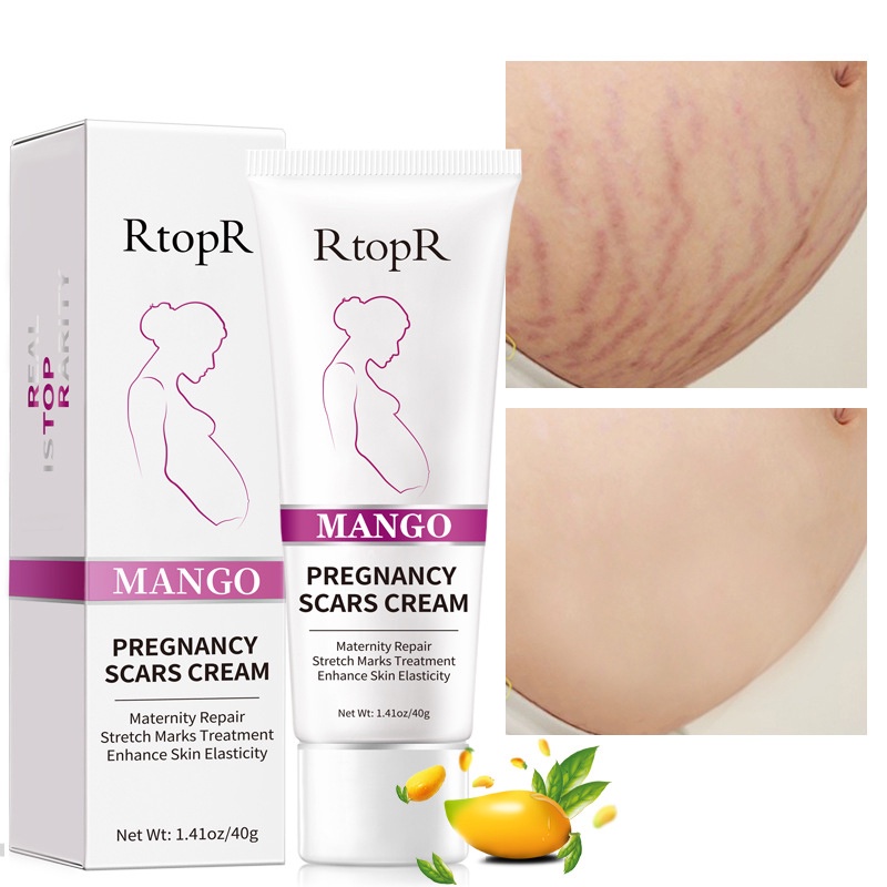 RtopR Xoài Xóa Sẹo Mang Thai Kem Rạn Da Kem Làm Săn Chắc Cơ Thể 40g YR