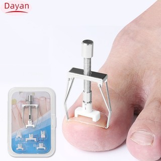 Thiết bị chỉnh sửa móng chân mọc ngược Kẹp thẳng bằng thép không gỉ Dụng cụ chăm sóc móng chân