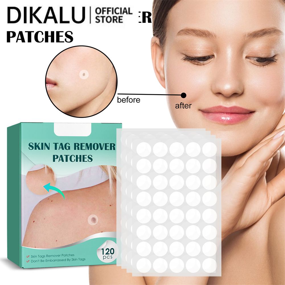 Hộp 120 miếng dán loại bỏ mụn thịt dư DIKALUan toàn không đau tác dụng nhanh