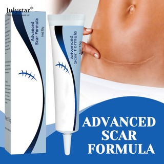 Kem xóa sẹo JULYSTAR 15g công thức giảm sẹo tiên tiến làm mờ loại bỏ vết rạn da phục hồi các đốm mụn làm trắng