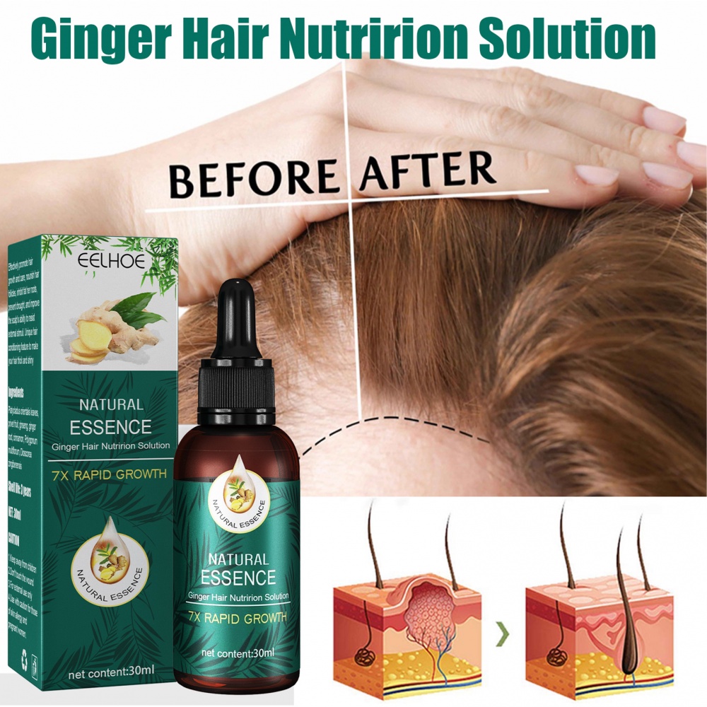 Tinh Dầu Gừng Kích Thích Mọc Tóc Và Mát Xa Da Đầu Tự Nhiên 30ml