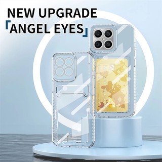 Ốp lưng Huawei Nova 10 9 8i 7i SE Pro Y70 Honor X6 X7 X8A X9A X9B 6D Bảo vệ Camera âm thanh Vỏ Silicon trong suốt
