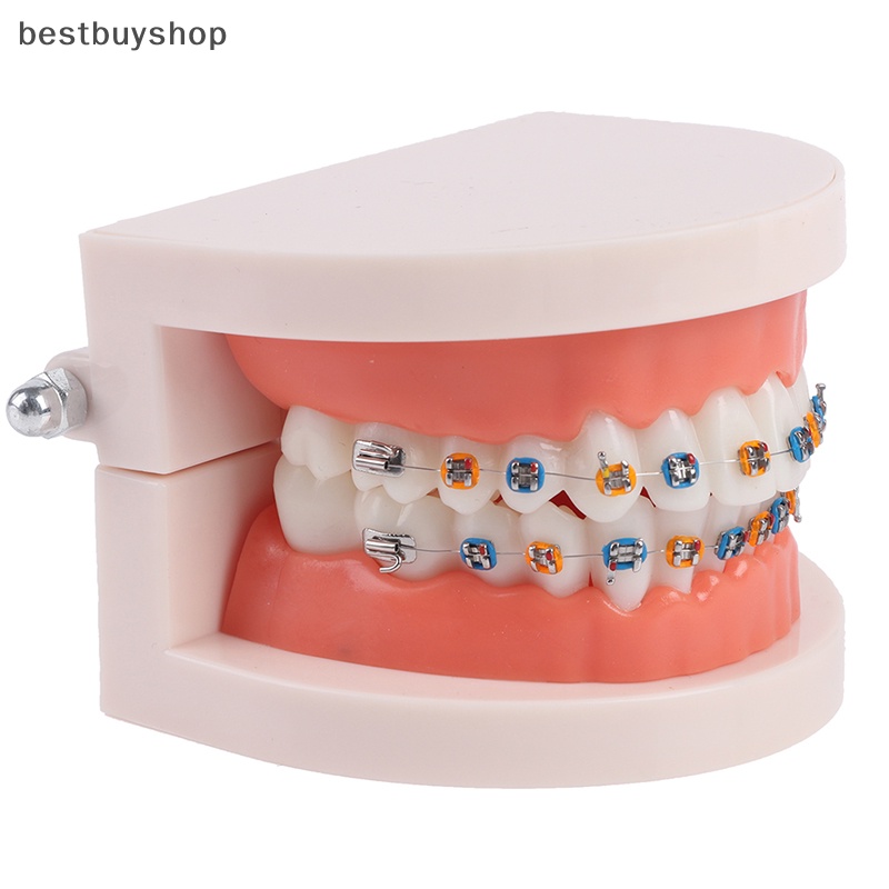 Cửa Hàng Tốt Nhất Mô Hình Răng Chỉnh Hình Bằng Kim Loại Với Thiết Bị Dạy Học Mẫu Mới