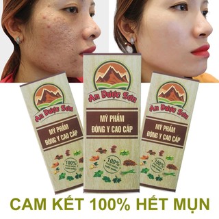 Serum An Dược Sơn 30ml