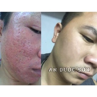 Serum An Dược Sơn 30ml