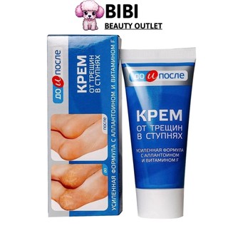 Kem làm mềm, giảm nứt nẻ gót chân kpem nga 50ml