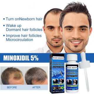 Tinh Chất Kích Thích Mọc Tóc minoxidil 5% minoxidil 60ml