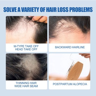 Tinh Chất Kích Thích Mọc Tóc minoxidil 5% minoxidil 60ml