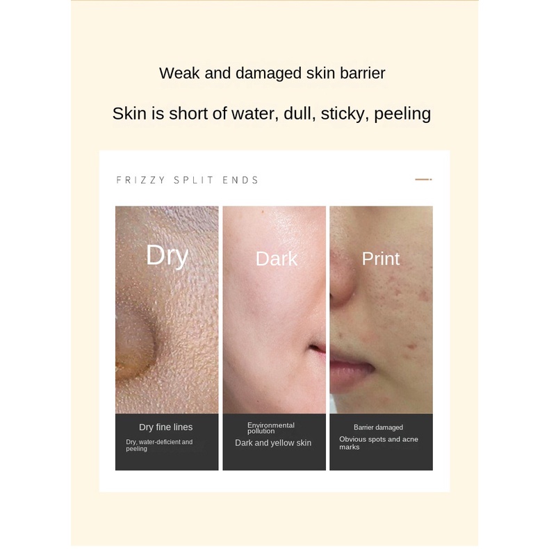 Kuge Tinh Chất Dưỡng Ẩm Chống Lão Hóa Và Nếp Nhăn Cho Da Mặt