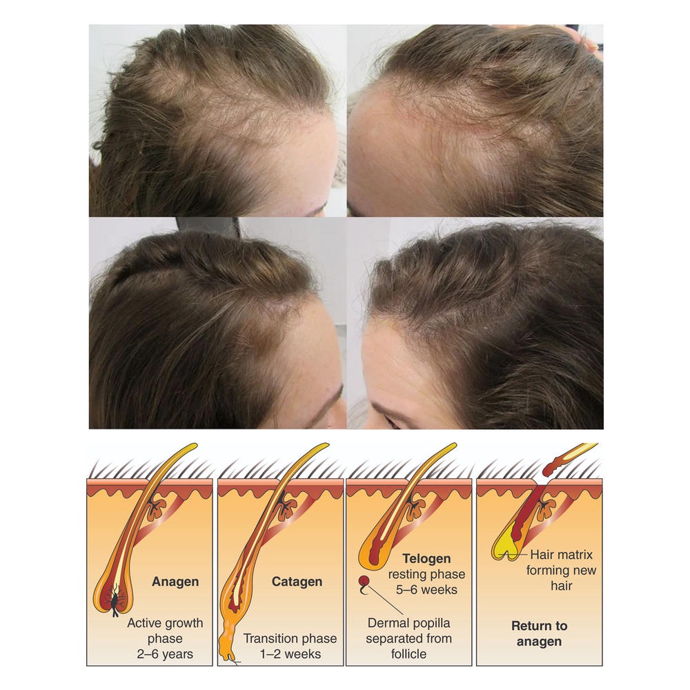 Xà Phòng Tinh Chất Gạo Giúp Mọc Tóc Nuôi Dưỡng Tóc