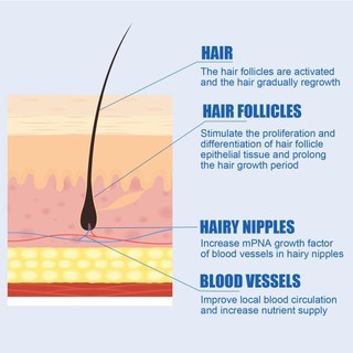 Tinh Chất Kích Thích Mọc Tóc minoxidil 5% minoxidil 60ml
