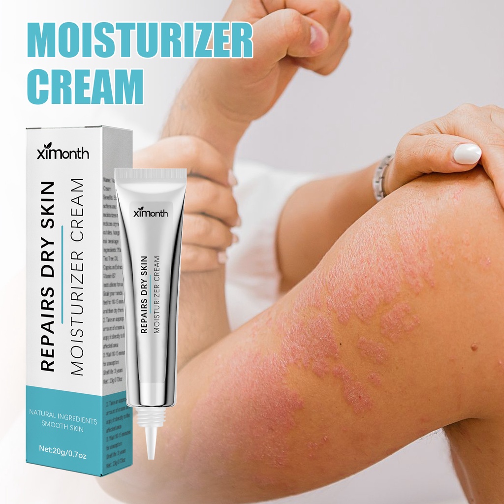 Kem Dưỡng Ẩm Kiểm Soát Dầu Thành Phần Tự Nhiên Chống Khô Da Hiệu Quả Trẻ Em Và Trẻ Em, eczema Flourma Flourma