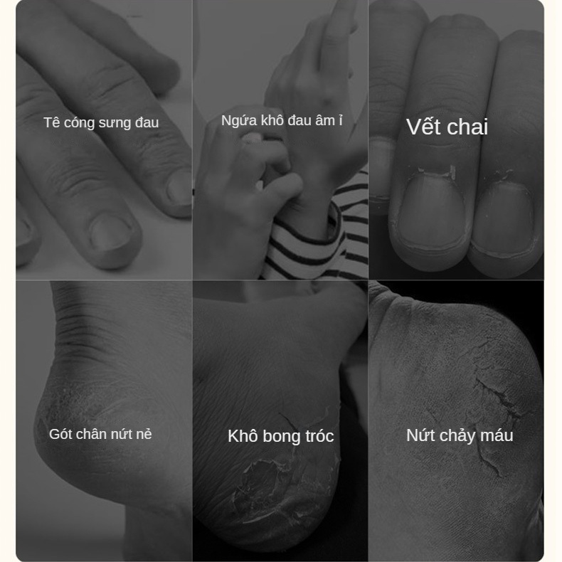 Kem dưỡng ẩm tay chân, dưỡng ẩm sâu, gót chống nứt nẻ, kem dưỡng ẩm tay chân, mùa thu đông 120g