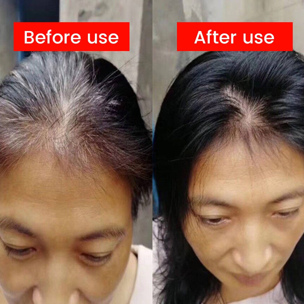 Herbal Chai Xịt Chứa polygonum Đa Chức Năng Giúp Chăm Sóc Tóc Đen Và Trắng