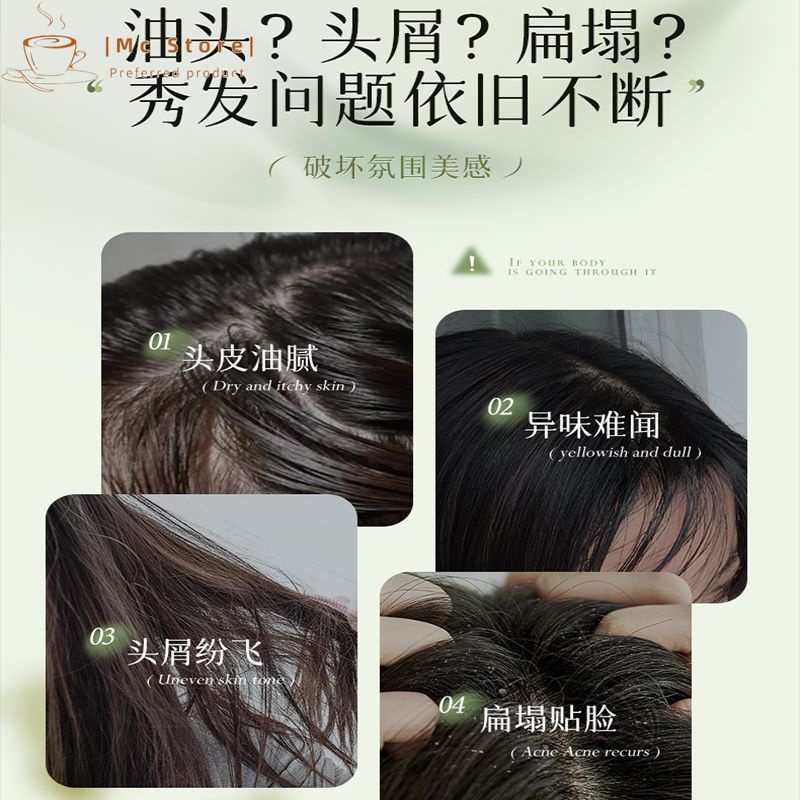 Vetes Dầu Gội / gel Tắm / Sữa Tắm / Dầu Xả Chống Gàu / Ngứa / Kiểm Soát Dầu / Lâu Trôi / Làm Sạch Sâu / Chăm Sóc Da