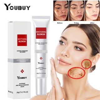 YOUBUY Kem Dưỡng Trắng Da Loại Bỏ Tàn Nhang 20g
